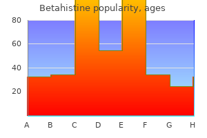 order betahistine with a mastercard