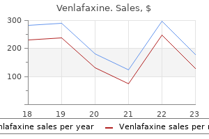 discount venlafaxine 150 mg amex