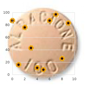 Brachymesophalangy type 2