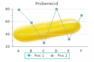 generic 500 mg probenecid with amex
