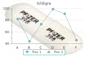 sildigra 50 mg buy free shipping