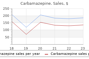 order carbamazepine american express