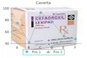 order 50 mg caverta with visa