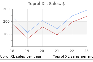 toprol xl 100 mg order with amex