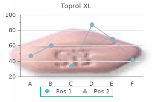 100 mg toprol xl purchase overnight delivery