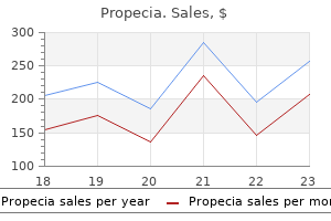 propecia 5 mg with amex