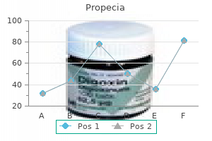 generic propecia 5 mg on line