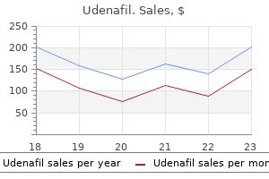 purchase 100 mg udenafil free shipping